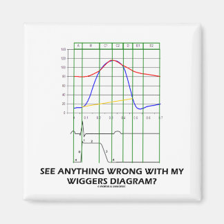 Imán ¿Ves Algo Equivocado Con Mi Diagrama De Wiggers?