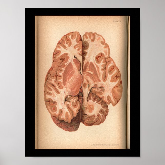 Impresión de anatomía cerebral de 1901 (Frente)