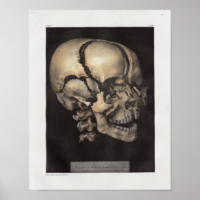 Impresión de anatomía de calavera humana de 1867 (Frente)