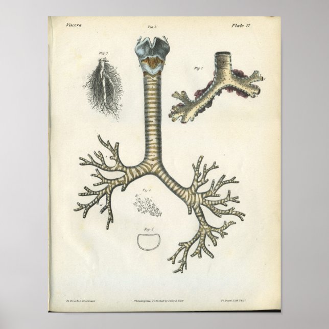 Impresión de Anatomía de Vintage de Lung Bronchi (Frente)
