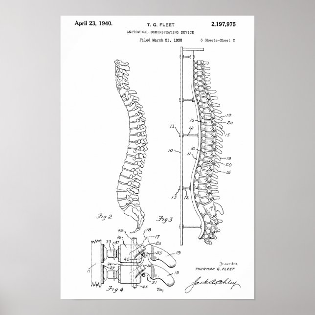 Impresión de arte de patente de espina dorsal anat (Frente)
