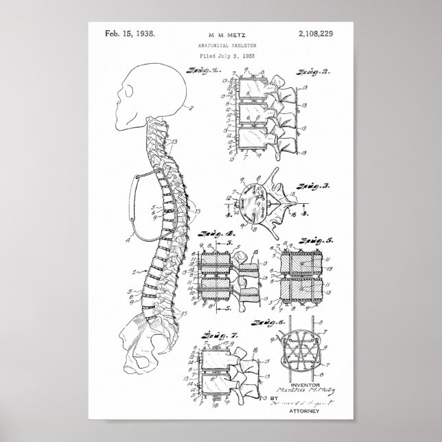 Impresión de arte de patente de modelo de columna  (Frente)