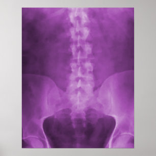 Impresión de arte digital de rayos X morado