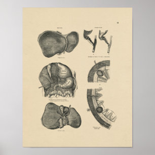 Impresión de la anatomía 1880 del hígado del