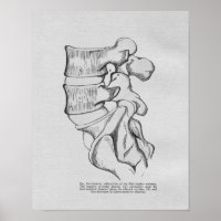 Impresión vintage de subluxación vertebral quiropr