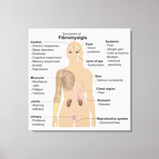 Imprimir en lienzo signos síntomas fibromialgia gr (Anverso)
