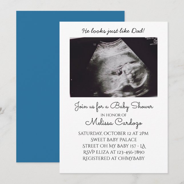 Invitación a Baby Shower por ecografía de Baby Boy (Anverso / Reverso)