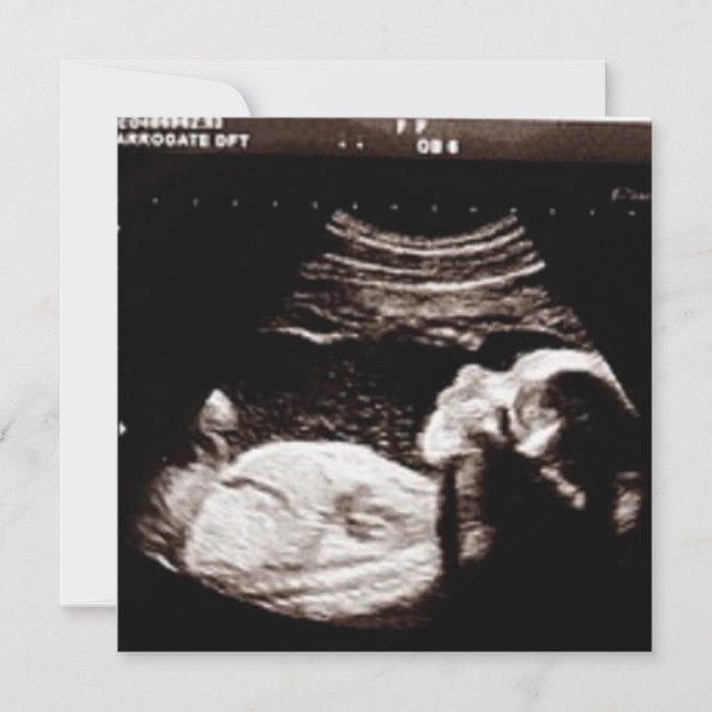Invitación Baby Shower de ultrasonido personalizado (Anverso)