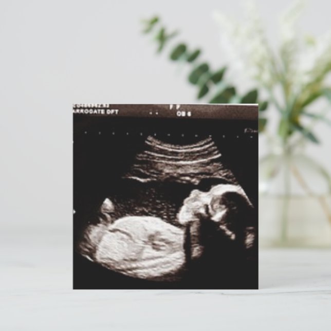 Invitación Baby Shower de ultrasonido personalizado (Anverso de pie)