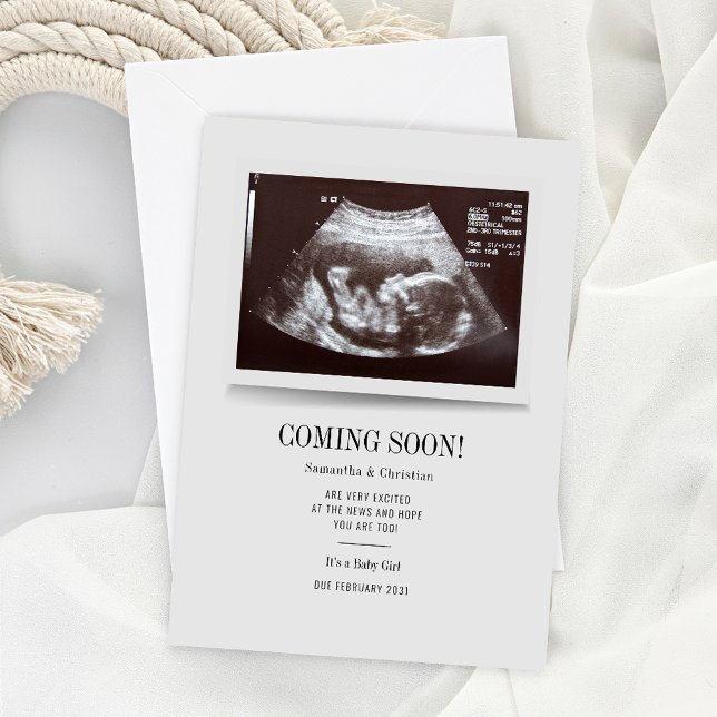 Invitación de embarazo por ultrasonido moderno (Custom Baby Announcement Sonogram Ultra Scan Photo)