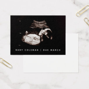 Invitación de embarazo Sonograma Mini paquete con