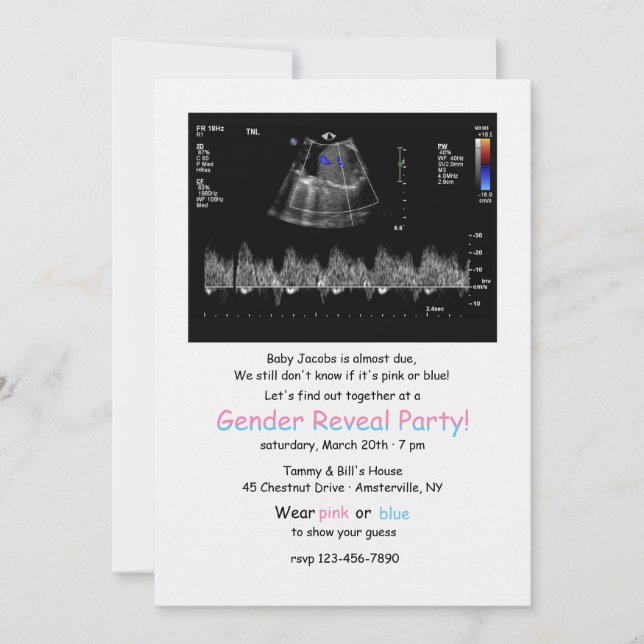 Invitación El género de la imagen del desplome fetal revela l (Anverso)