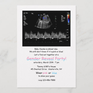 Invitación El género de la imagen del desplome fetal revela l