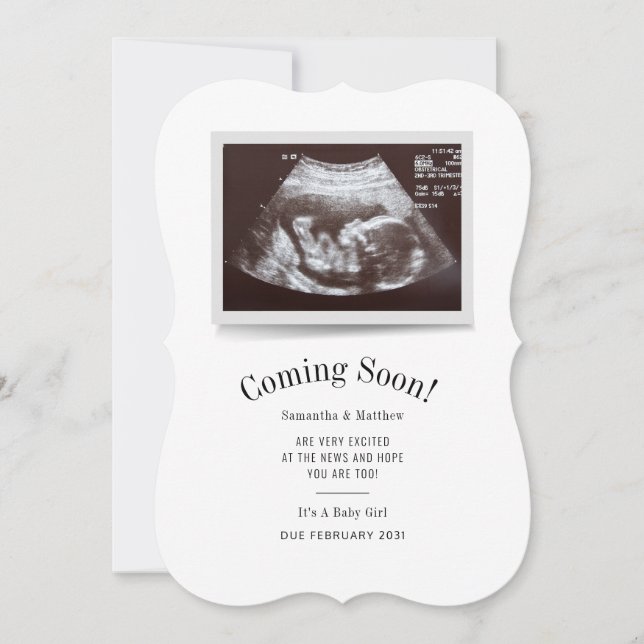 Invitación Próximamente, revelación de género de foto de ultr (Anverso)