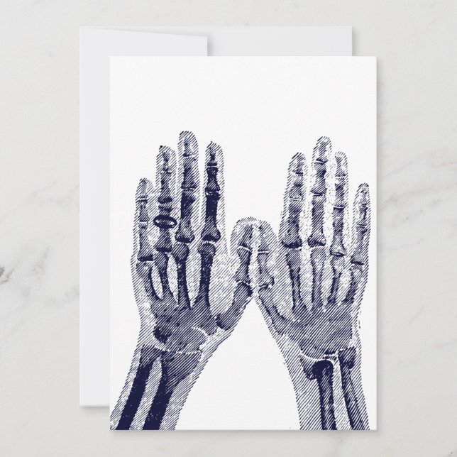 Invitación Skeleton Hands Xray Picture dibujando anatomía hum (Anverso)