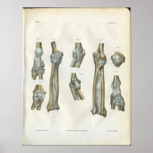 Juntas de la impresión de la anatomía del codo y