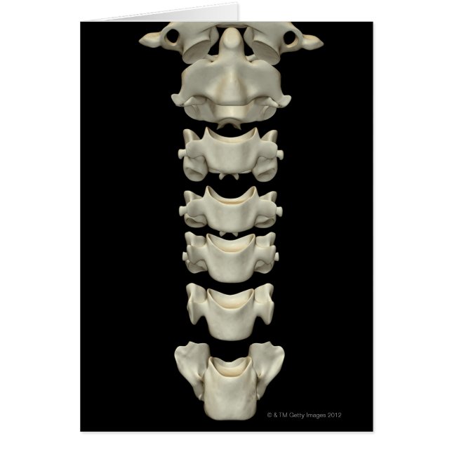 La vértebra cervical 7 (Frente)