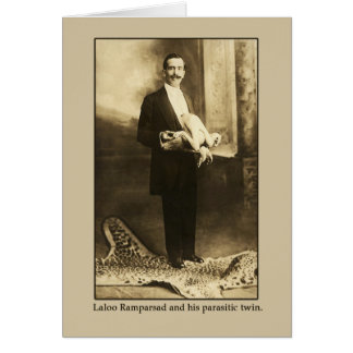 Laloo, el feliz hindoo con un gemelo parasitario