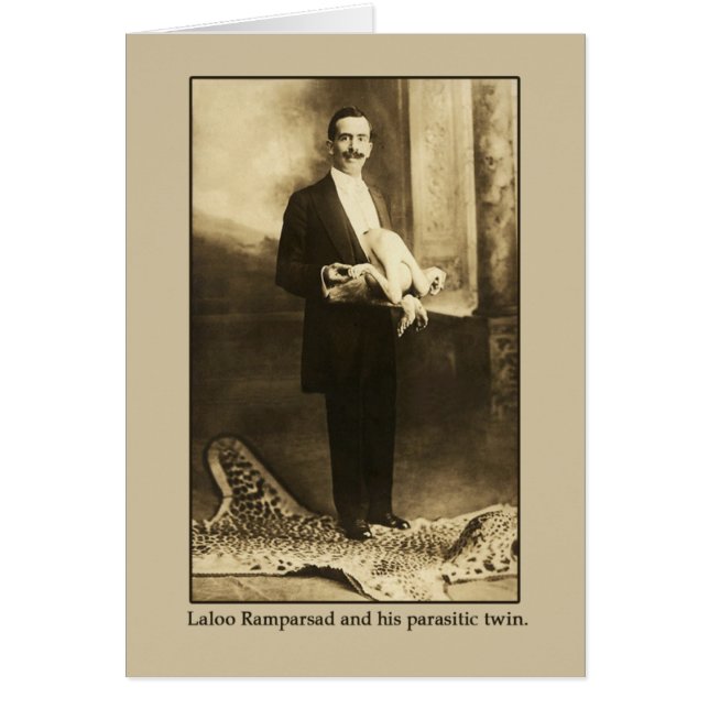 Laloo, el feliz hindoo con un gemelo parasitario (Frente)