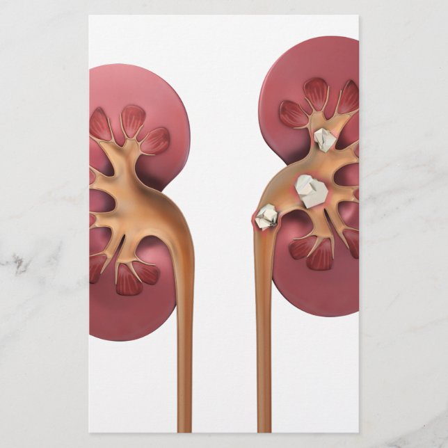 Lámina riñones (Anverso)