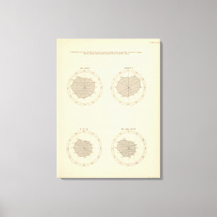 Lienzo 113 muertes por el mes 1900