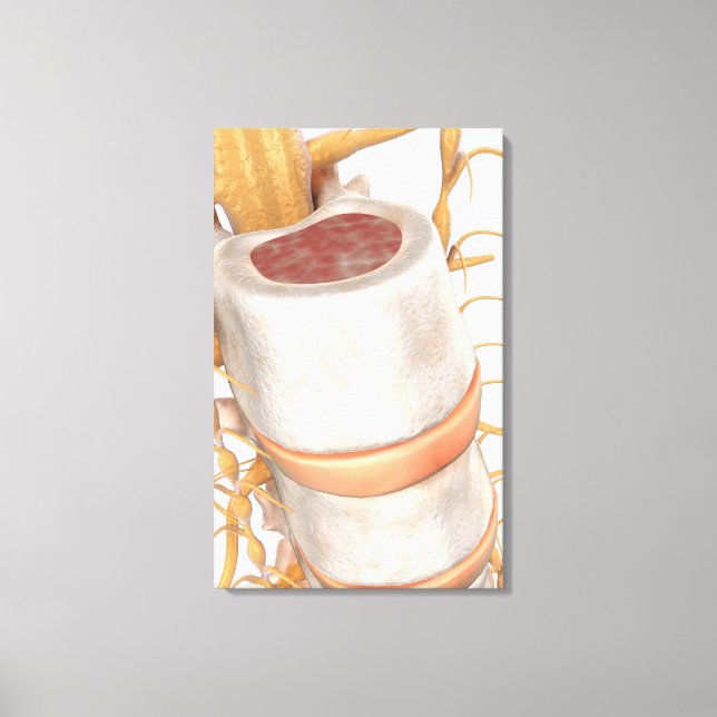 Lienzo Cierre de un disco invertebral en la columna verte (Anverso)