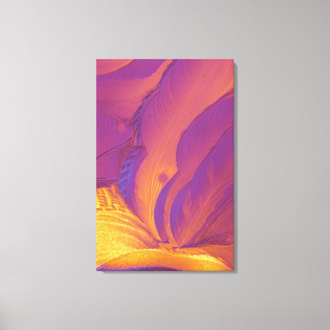 Lienzo Cristales ácidos tartáricos (Anverso)