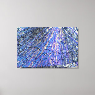 Lienzo Cristales del colesterol vistos en la luz