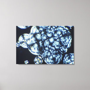 Lienzo Cristales del colesterol vistos en luz polarizada