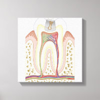 Ilustracion de la caries dental