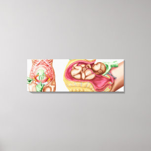 Lienzo Ilustracion que muestra la entrega cesariana del