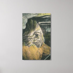 Lienzo Opinión el órgano