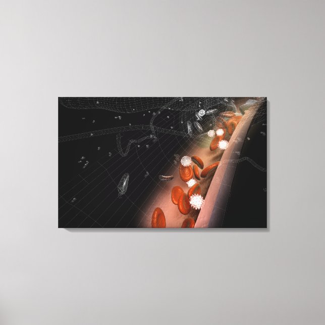 Lienzo Plaque en las arterias (Anverso)