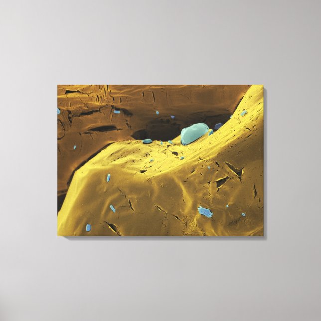 Lienzo Polvo de urea (Anverso)