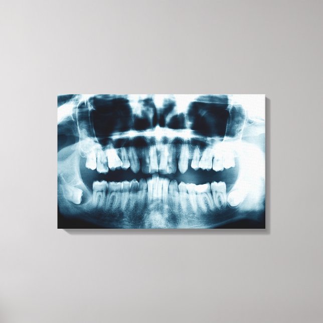 Lienzo Radiografía de dientes (Anverso)