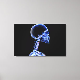 Lienzo Radiografía de los huesos en el cuello