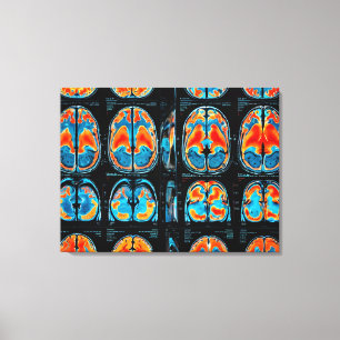 Lienzo Revisión cerebral por resonancia magnética