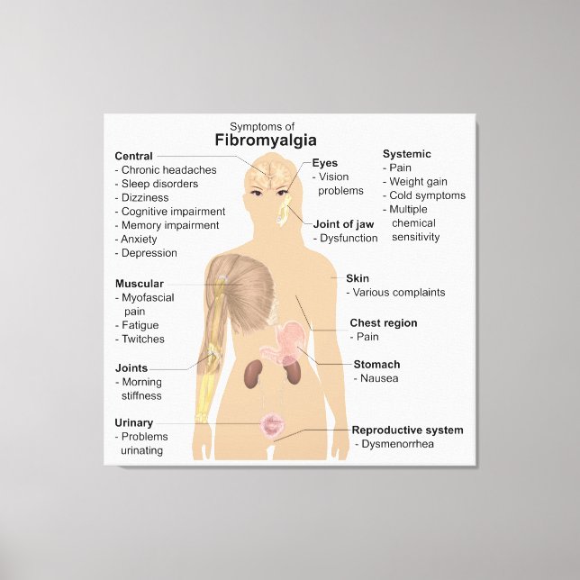 Lienzo Rótulos de gráfico Síntomas Fibromialgia Imprimir (Anverso)