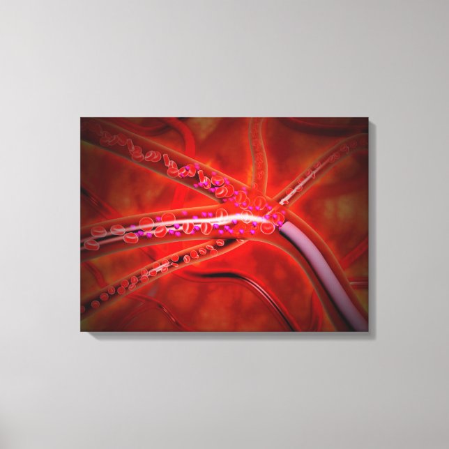 Lienzo Vista Microscópica Del Medicamento Que Se Está Iny (Anverso)