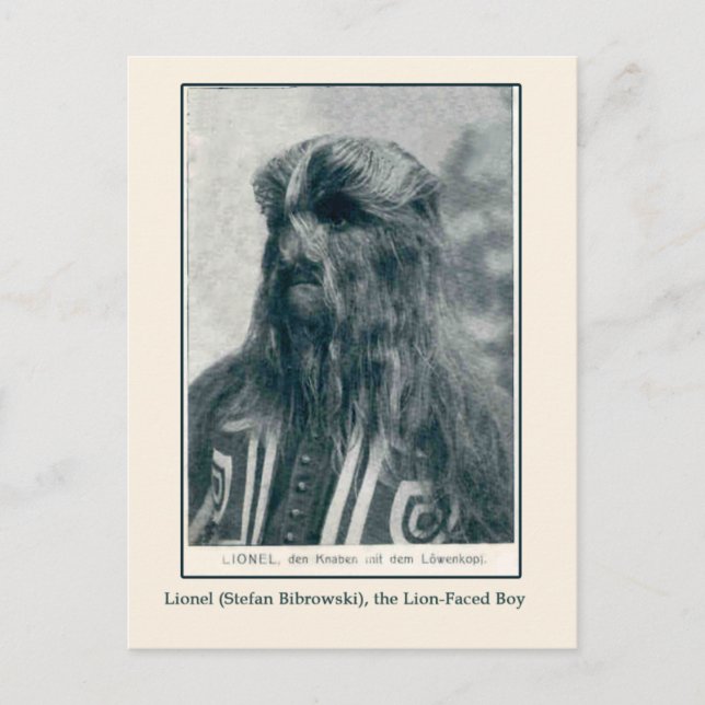 Lionel, las tarjetas y postales de los chicos enfr (Anverso)