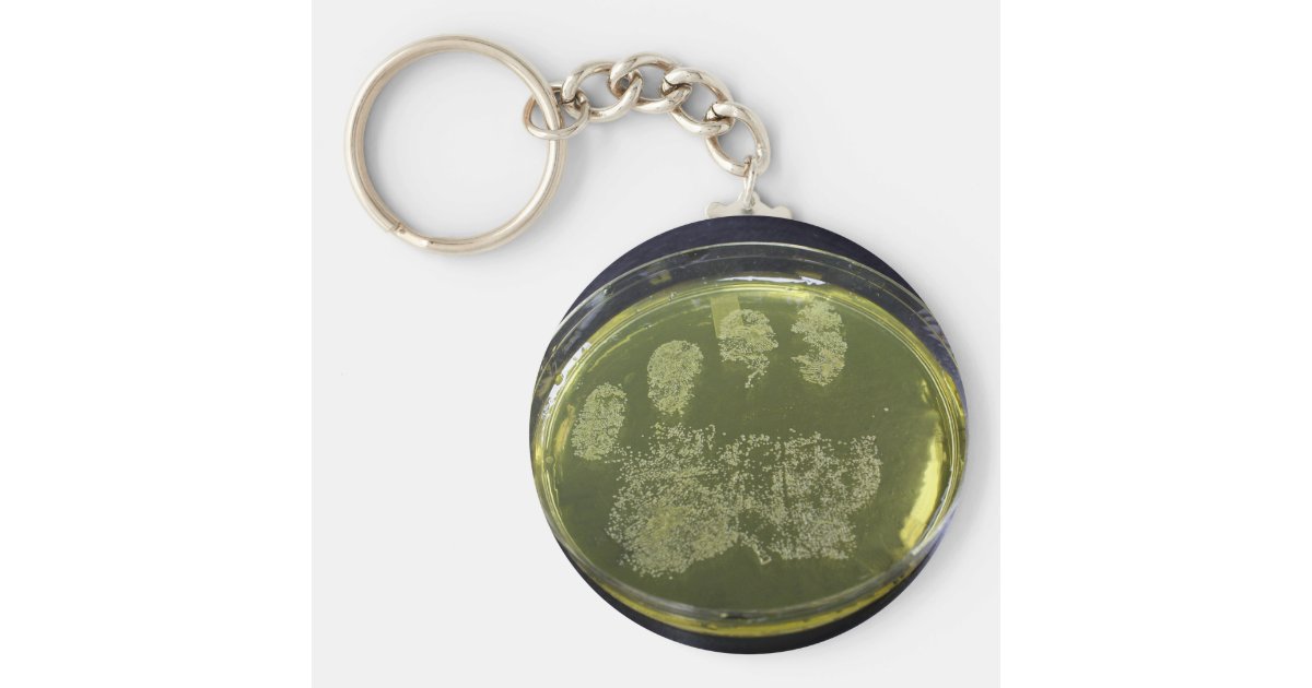 sal Estragos Isla Stewart Llavero Bacterias de la placa de Petri de la mano | Zazzle.es