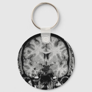 Llavero Brain MRI, coronal slice
