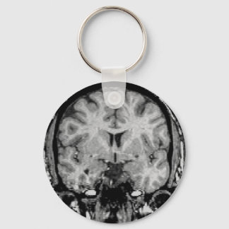 Llavero Brain MRI, coronal slice