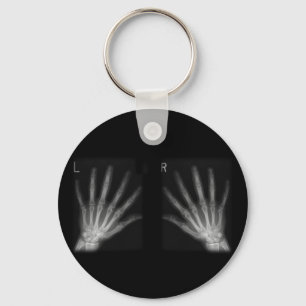 Llavero Extra Digit X-ray Right & Left Hands