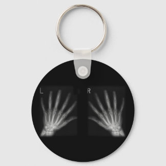 Llavero Extra Digit X-ray Right & Left Hands