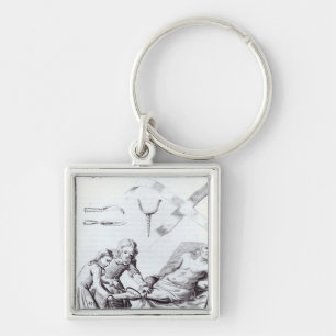 Llavero Operación quirúrgica para amputar una pierna