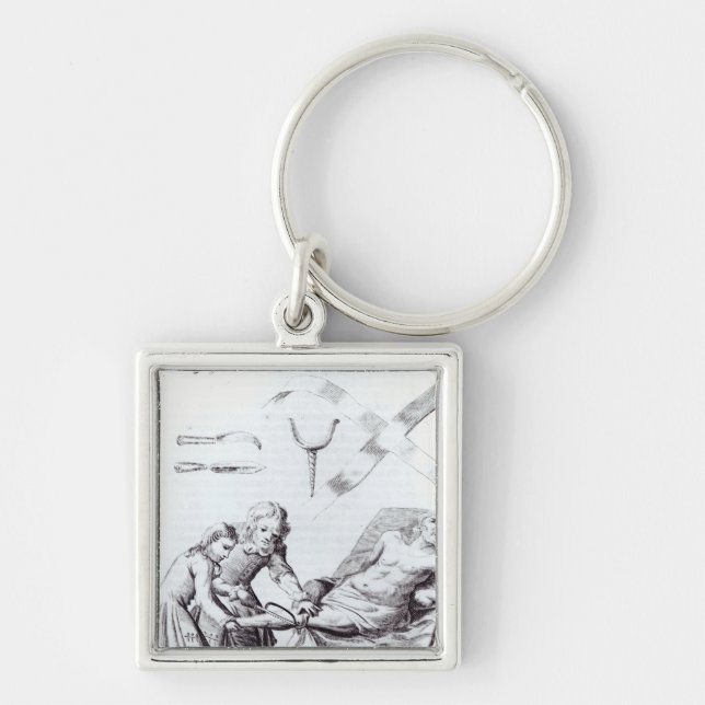 Llavero Operación quirúrgica para amputar una pierna (Frente)