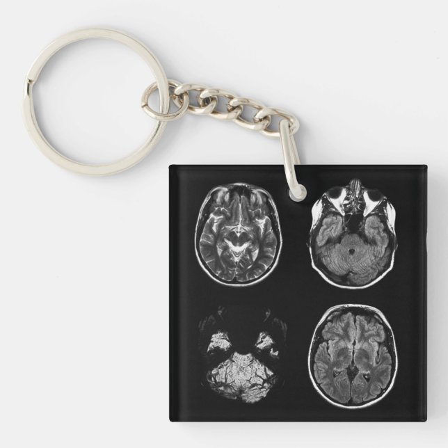 Llavero Resonancia magnética cerebral (Frente)