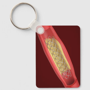 Llavero Stent médico dentro del vaso sanguíneo