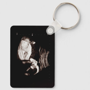 Llavero Ultrasonido de bebé personalizado